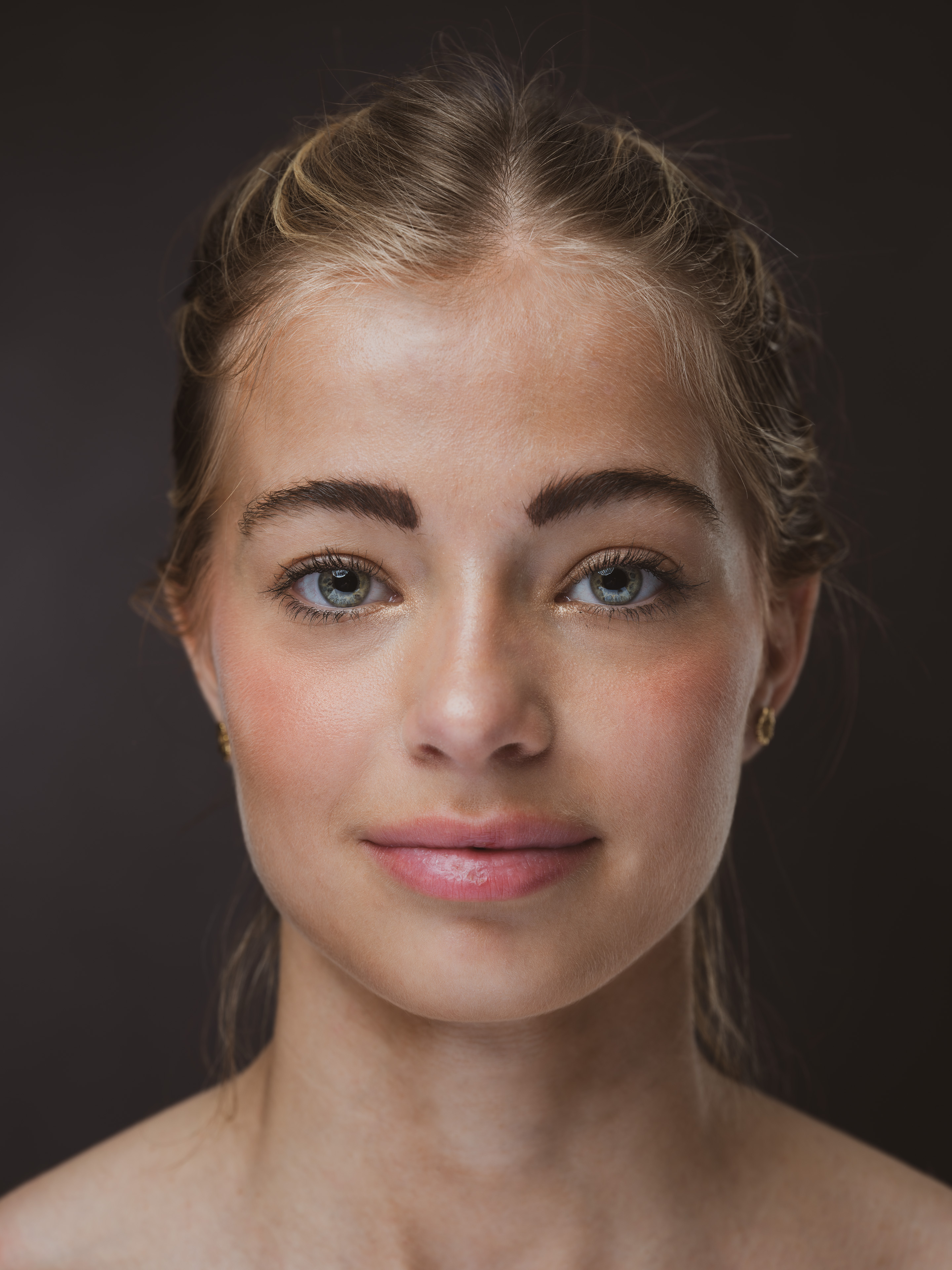 Noa